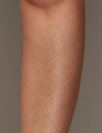 Effective IPL Hair Removal for Leg area with Ulike Air10